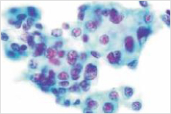 細胞診のイメージ