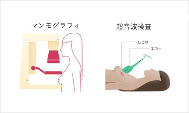 マンモグラフィと超音波検査のイメージ