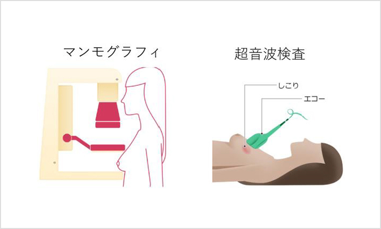 乳がんの診断と治療 | 乳腺外科 | 熊本の産婦人科 福田病院（熊本県