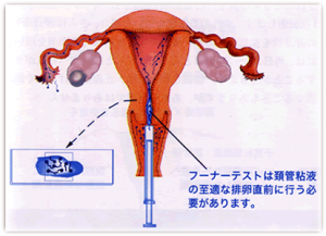 フーナーテスト した 周期 妊娠